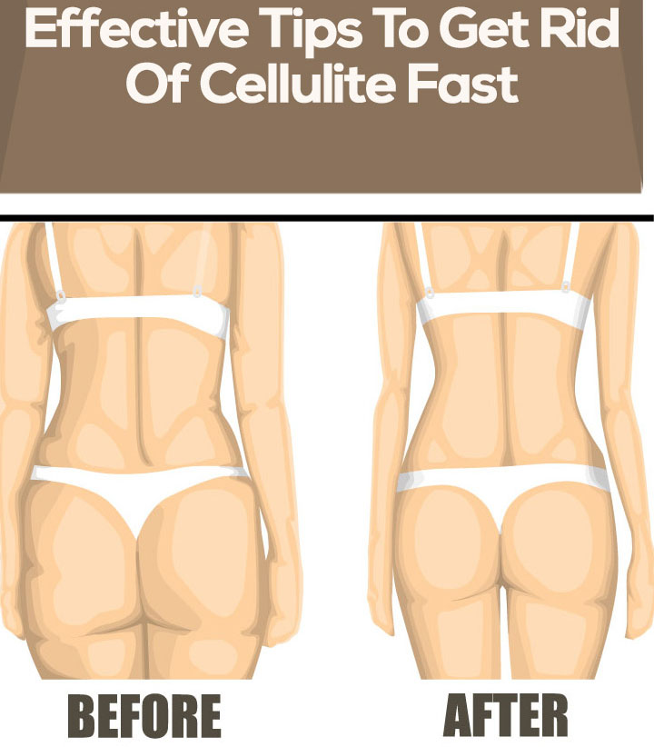Effective Tips To Get Rid Of Cellulite Fast