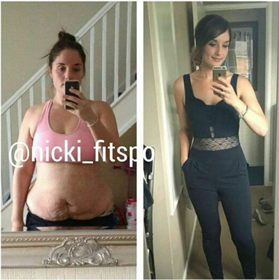 Before and after weight loss pictures