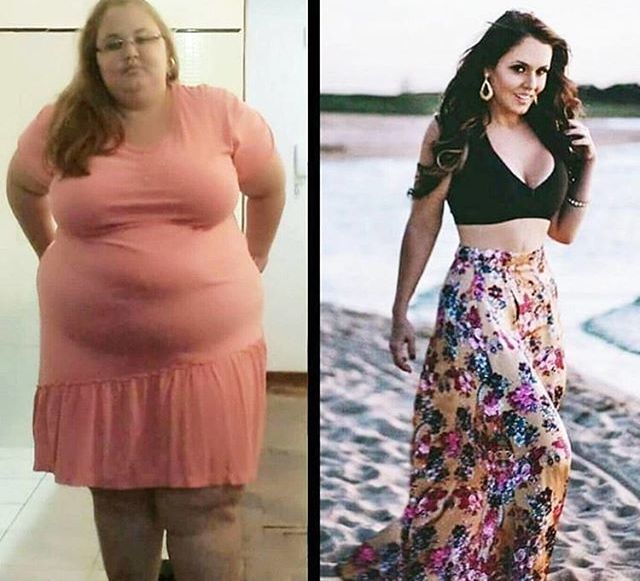 after weight loss
