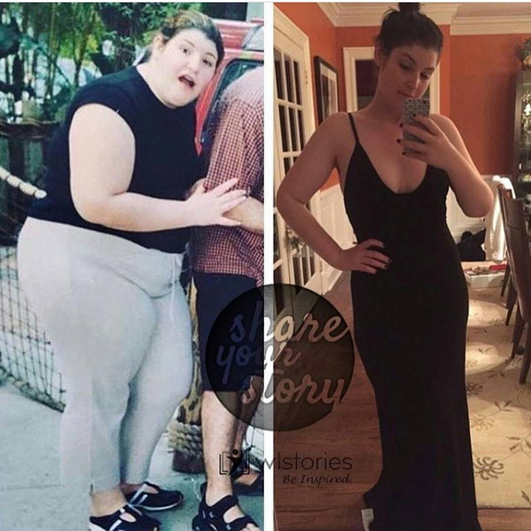 before and after weight loss photos,