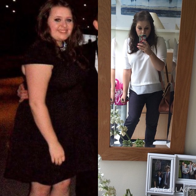 before and after weight loss success stories