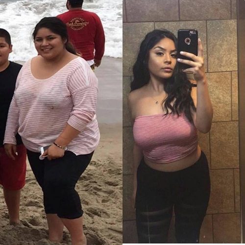 Before and after weight loss pictures!