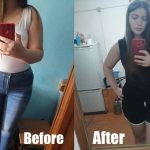 Before & After Weight Loss Story