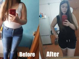 Before & After Weight Loss Story