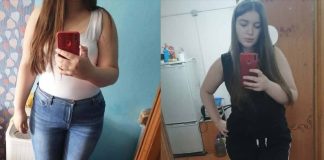 Before & After Weight Loss Story