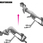Hyperextension