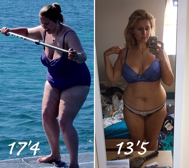My weight loss story