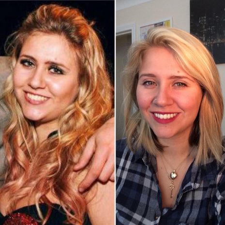 Lemon Water for Weight Loss: Fact or Myth?