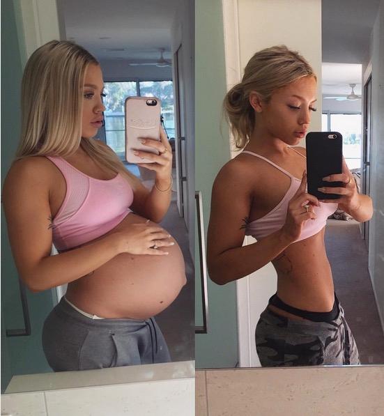 before and after pregnancy