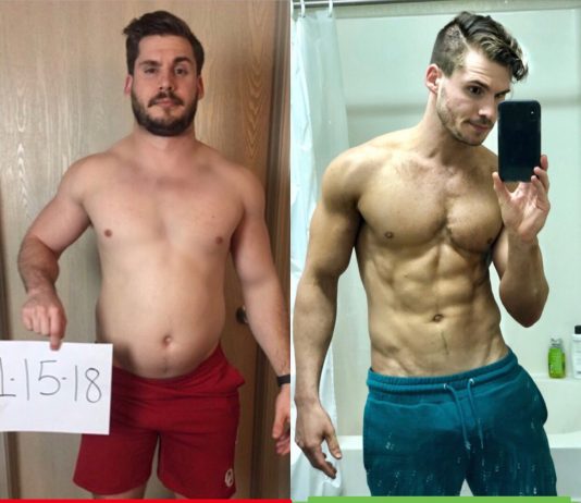 Before and after losing weight