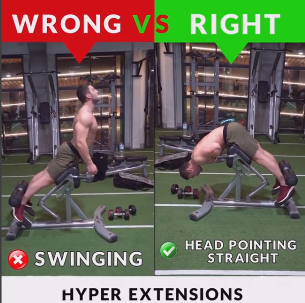 HOW TO HYPER EXTENSIONS WRONG