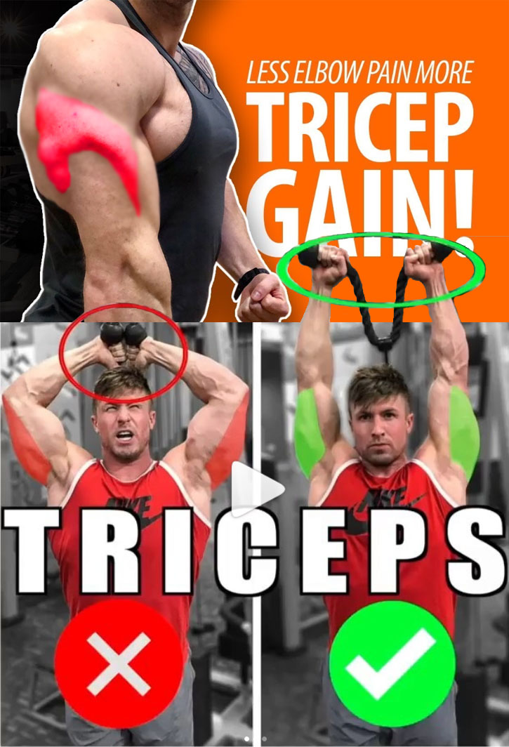 TRICEPS EXTENSION