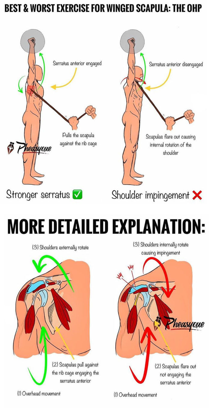 Best Worst Exercise For The Winged Scapula