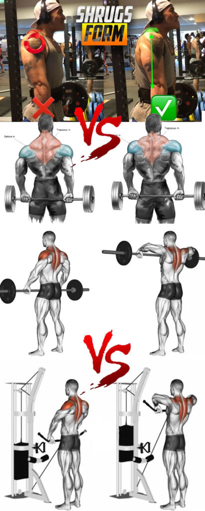 TIGHT UPPER TRAPS & SHOULDER IMPINGEMENT