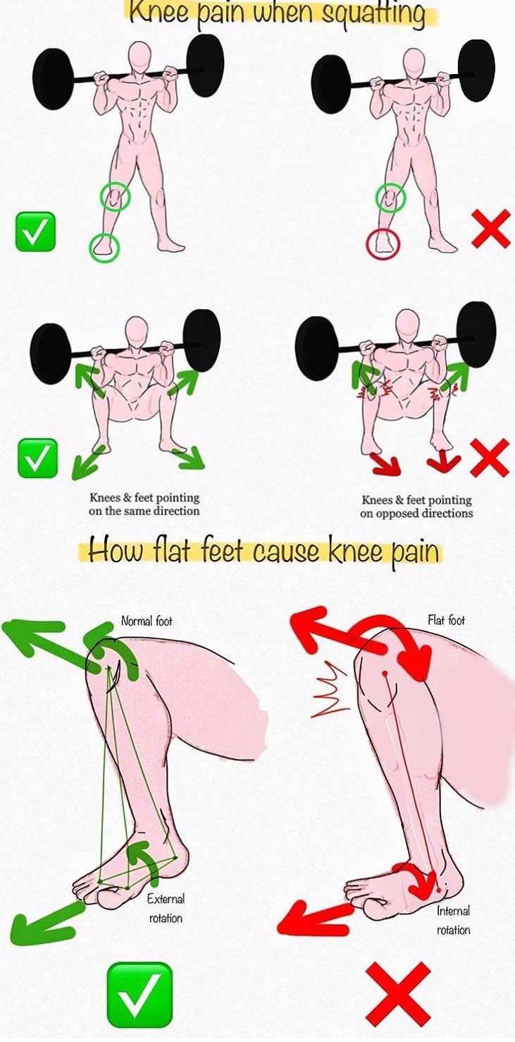 Knee pain when squatting