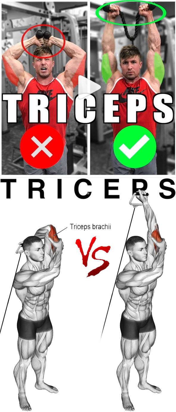 Triceps Cable Extension