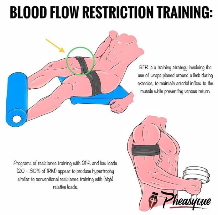 BLOOD FLOW RESTRICTION TRAINING (BFR)