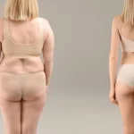 How retatrutide helps in managing diabetes and obesity