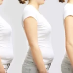 Precautions and Considerations for Retatrutide Therapy